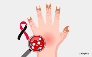 Sepsis Awareness Quiz Banner
