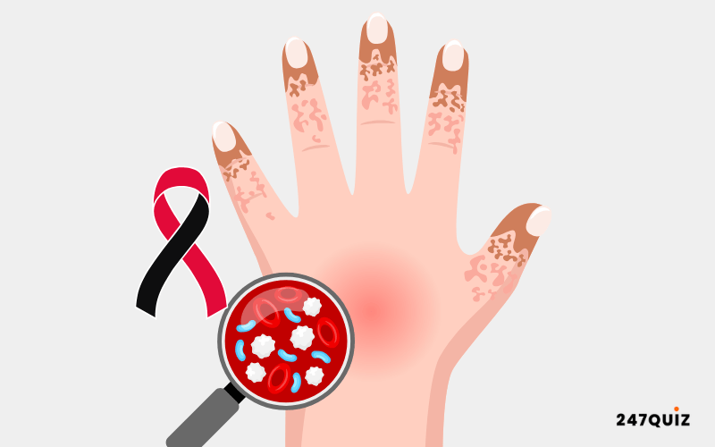 Sepsis Awareness Quiz