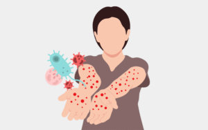 Sepsis is a life-threatening emergency