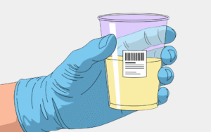 health care check of urine